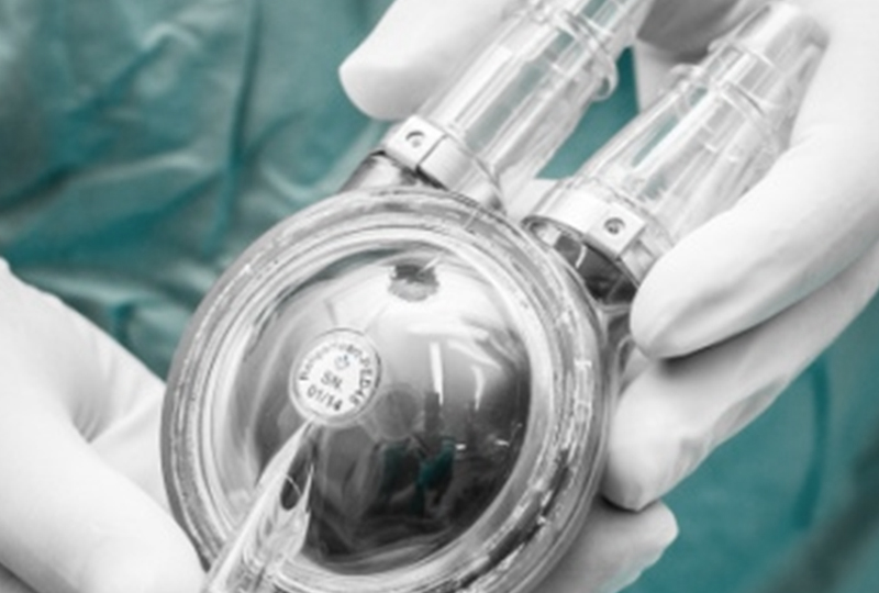 #BiOvalve